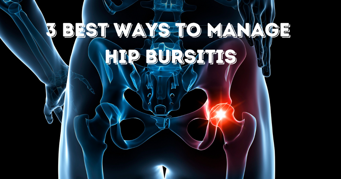 3 Best Ways to Manage Hip Bursitis